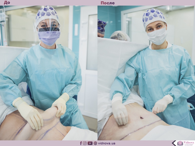 news_upload_2